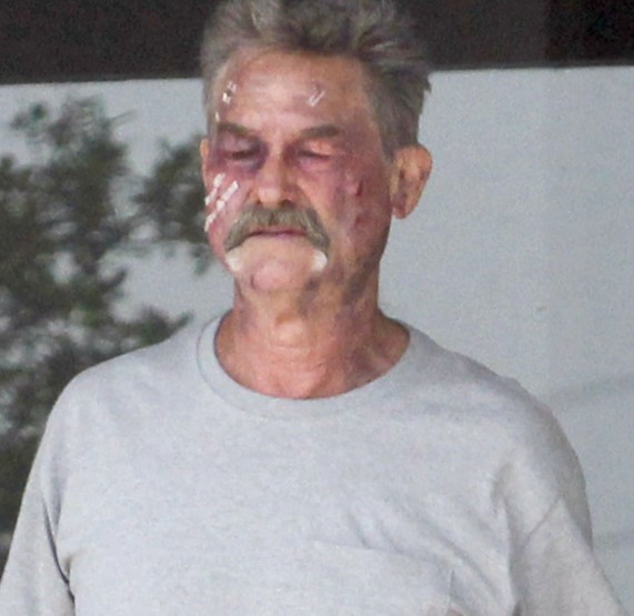 Kurt Russell injury